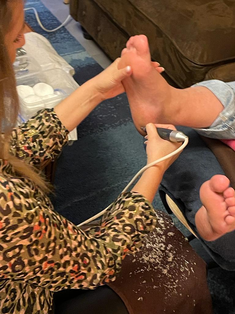Eelt verwijderen pedicure-behandeling Langdorp